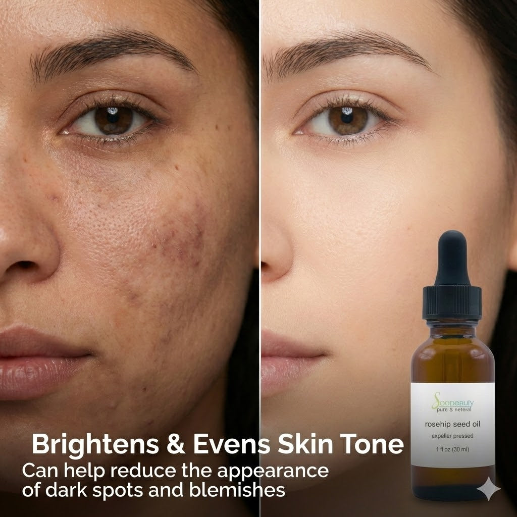 Rosehip Seed Oil Refined